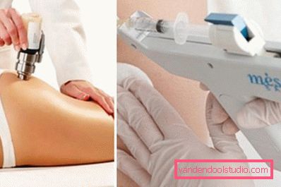 mesotherapy for vekttap mesotherapy for vekttap