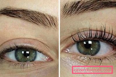 botox effekt botox effekt