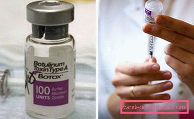 botox ampul botox ampul