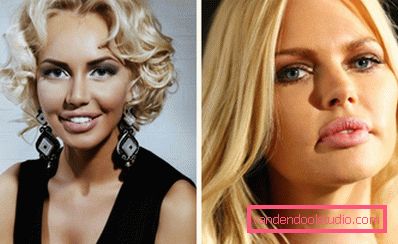 stjerner med botox i leppene stjerner med botox i leppene