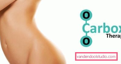 carboxytherapy carboxytherapy