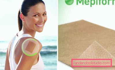 Mepiform lapp Mepiform lapp