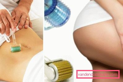 behandling av kroppsdeler med dermaroller behandling av kroppsdeler med dermaroller