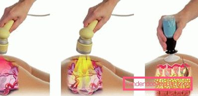 ultralyd mesoterapi ultralyd mesoterapi