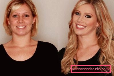 blond etter prosedyren blond etter prosedyren