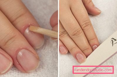 Nail overflatebehandling Nail overflatebehandling