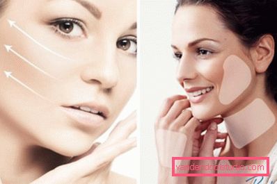 Restylane foryngelse Restylane foryngelse